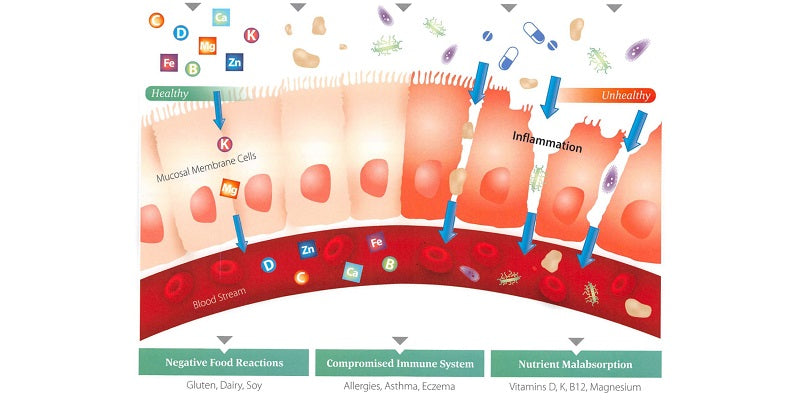Leaky Gut, Intestinal Permeability