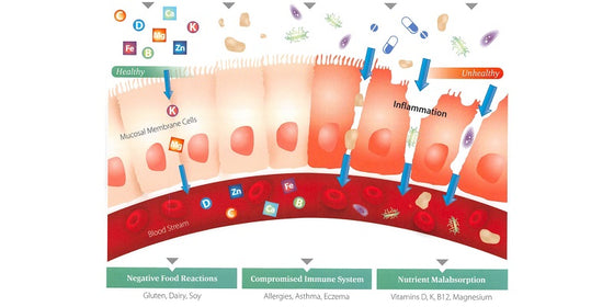 Leaky Gut, Intestinal Permeability